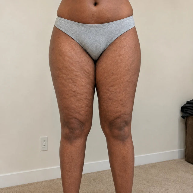 Day 1, hip, before