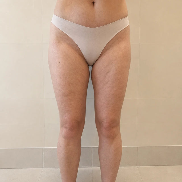 Day 15, bum, after