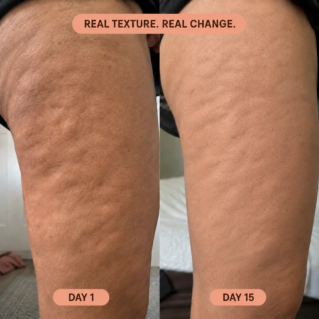 Real customer 15-day before and after results.